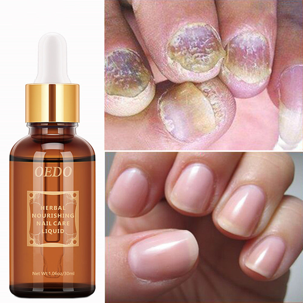 Healthy Nail Care Fungus Repair Essential Oil