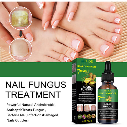 Nail Repair Solution Hand Foot And Nail Care