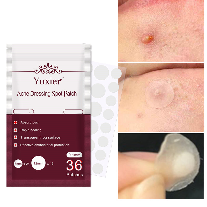 Acne Stickers Pimple Remover Set