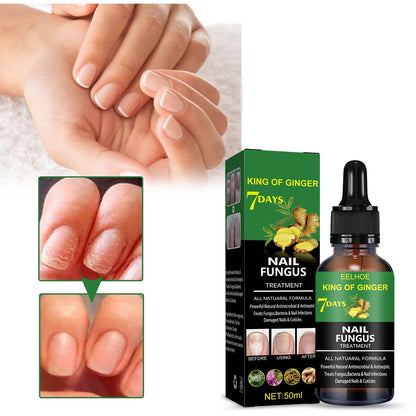 Nail Repair Solution Hand Foot And Nail Care