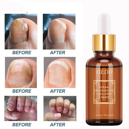 Healthy Nail Care Fungus Repair Essential Oil