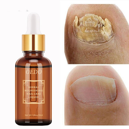 Healthy Nail Care Fungus Repair Essential Oil