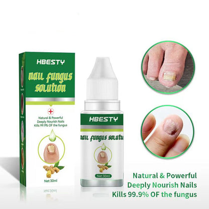 Foot Toe Nail Fungus Removal Gel